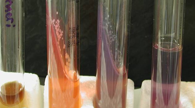 4 новые инфекции, которые передаются половым путем и представляют для вас опасность