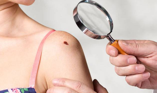 Рак убивает 18 человек в минуту – 5 советов врачей и ранние симптомы рака