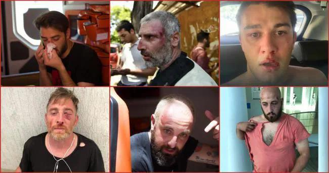 Журналисты, операторы и фотографы, пострадавшие в ходе сегодняшних событий в Тбилиси – в списке 47 представителей 16 СМИ