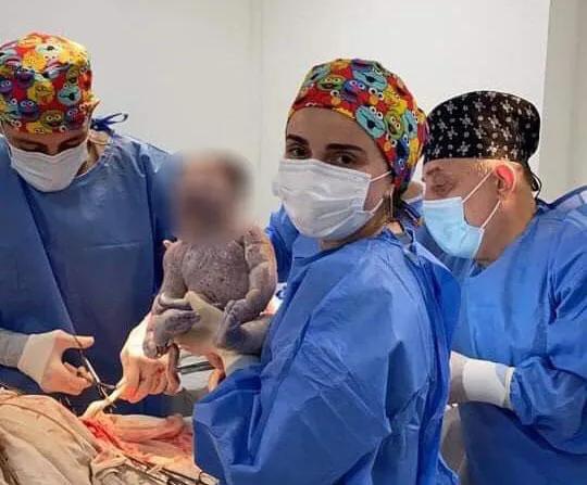 47-летняя ковид-положительная женщина стала мамой близнецов - женщина ждала ребенка 10 лет