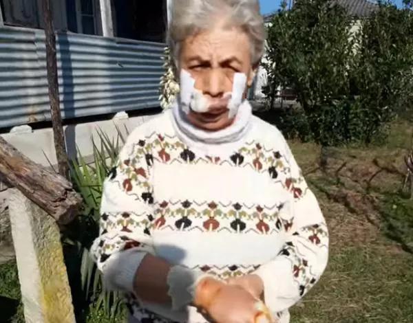 «Я ела королек и не обратила внимания, думала, что это собака» - в Хони на женщину напал шакал