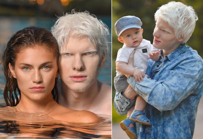 «Как выглядит ребенок самого красивого альбиноса и грузинской модели» — что пишет российская пресса о семье Беры Иванишвили