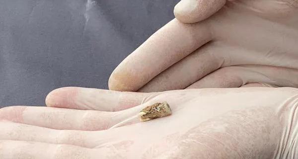 «Сенсационное открытие мирового значения» — в Дманиси, Орозмани археологи нашли человеческий зуб возрастом 1,8 миллиона лет