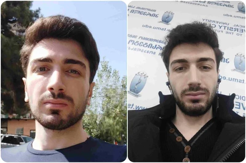 Убийство в Тбилиси: молодого человека встретили у дома и расправились физически, он скончался в клинике